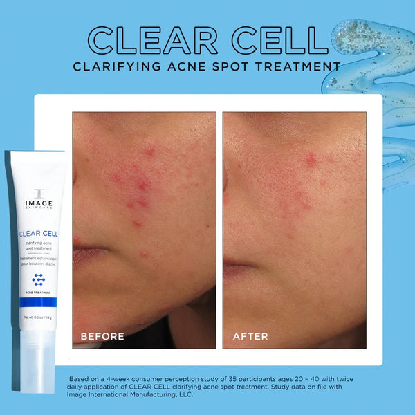 CLEAR CELL clarifying acne spot treatment Image Skincare