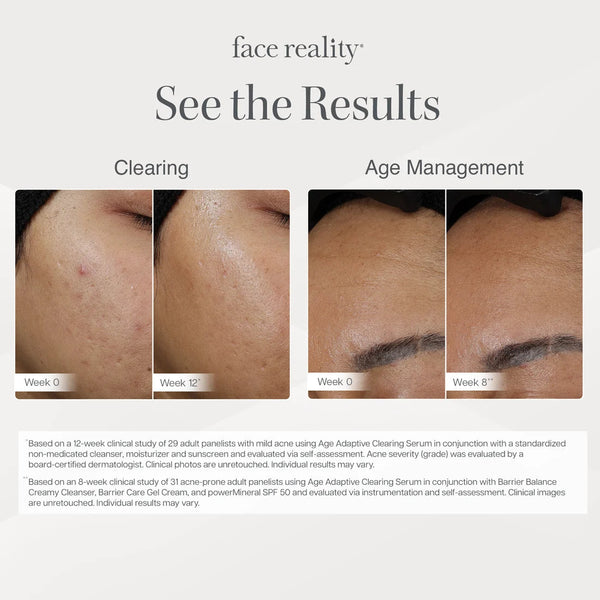 Face Reality Age Adaptive Clearing Serum Skin by Leah